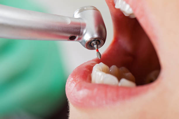 Best Emergency Root Canal Treatment in Kibler, AR